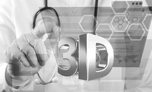 3D打印具有那些優(yōu)勢？