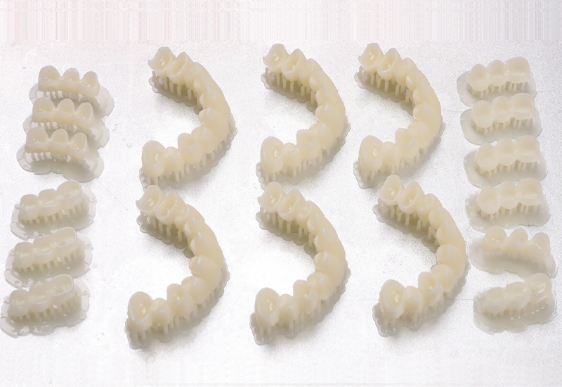 3d打印臨時牙冠多少錢？