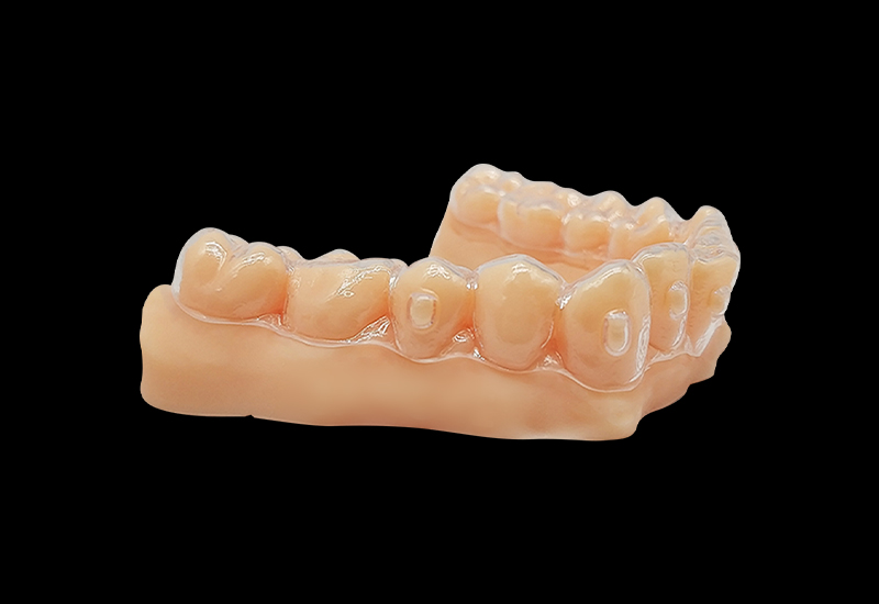 什么是3d打印正畸牙模？3d打印正畸牙模怎么做？